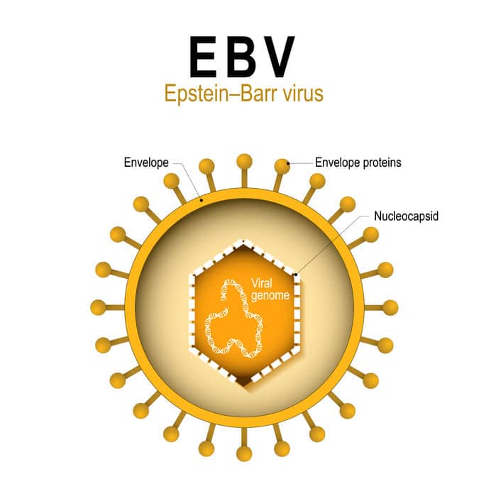 epstein barr virus thyroid