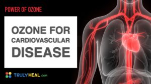 Ozone for cardiovascular disease